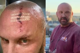 Graham, a construction site manager, said he was mistaken by cops as the aggressor after he was attacked by a group of thugs with cones.