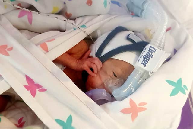 The tiny tot has spent the first weeks of his life in intensive care at Bristol Children’s Hospital.