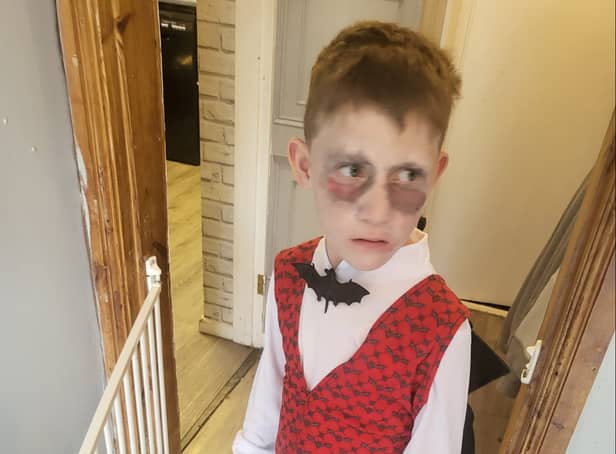 <p>Toby remained in PICU at Bristol Royal Hospital for Children. for eight days where he was diagnosed with bacterial meningitis.</p>
