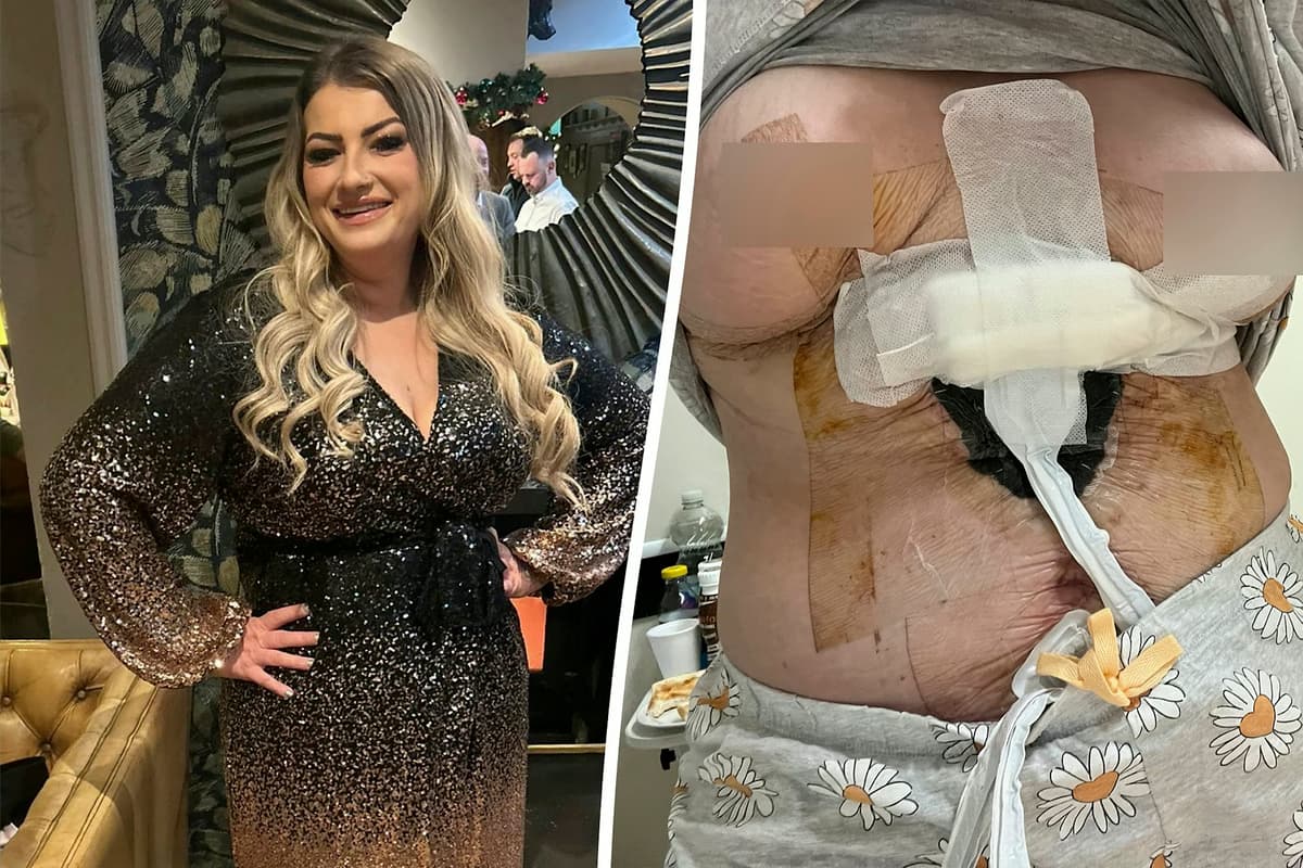 My nipple fell off after botched breast surgery abroad left me with gaping  hole in my chest